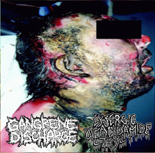 Gangrene Discharge : Gangrene Discharge - Lysergic Acid Diethylamide